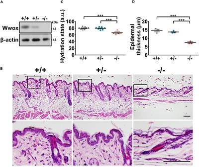 Wwox Deficiency Causes Downregulation of Prosurvival ERK Signaling and Abnormal Homeostatic Responses in Mouse Skin